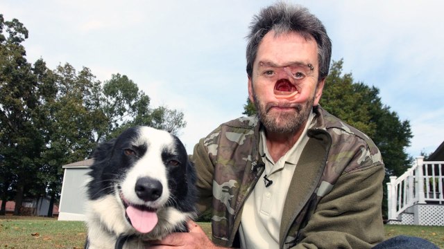 L'homme avec un trou dans le visage