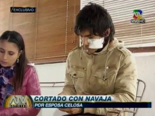 Mujer corta la cara a su pareja por celos