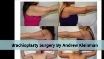 Kleinman Plastic Surgery Arm Lift Recovery