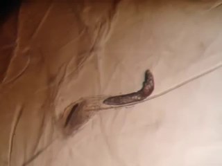 Les Demodex : ces petites bêtes qui vivent sur votre visage