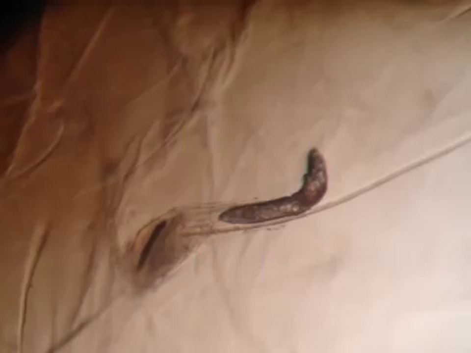 Les Demodex : ces petites bêtes qui vivent sur votre visage