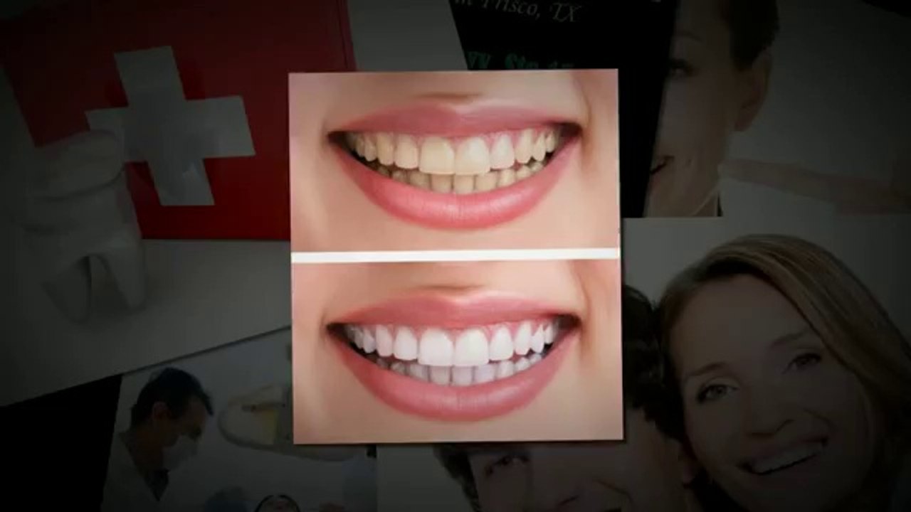 Local Dentist Frisco TX  Call 972-335-7666