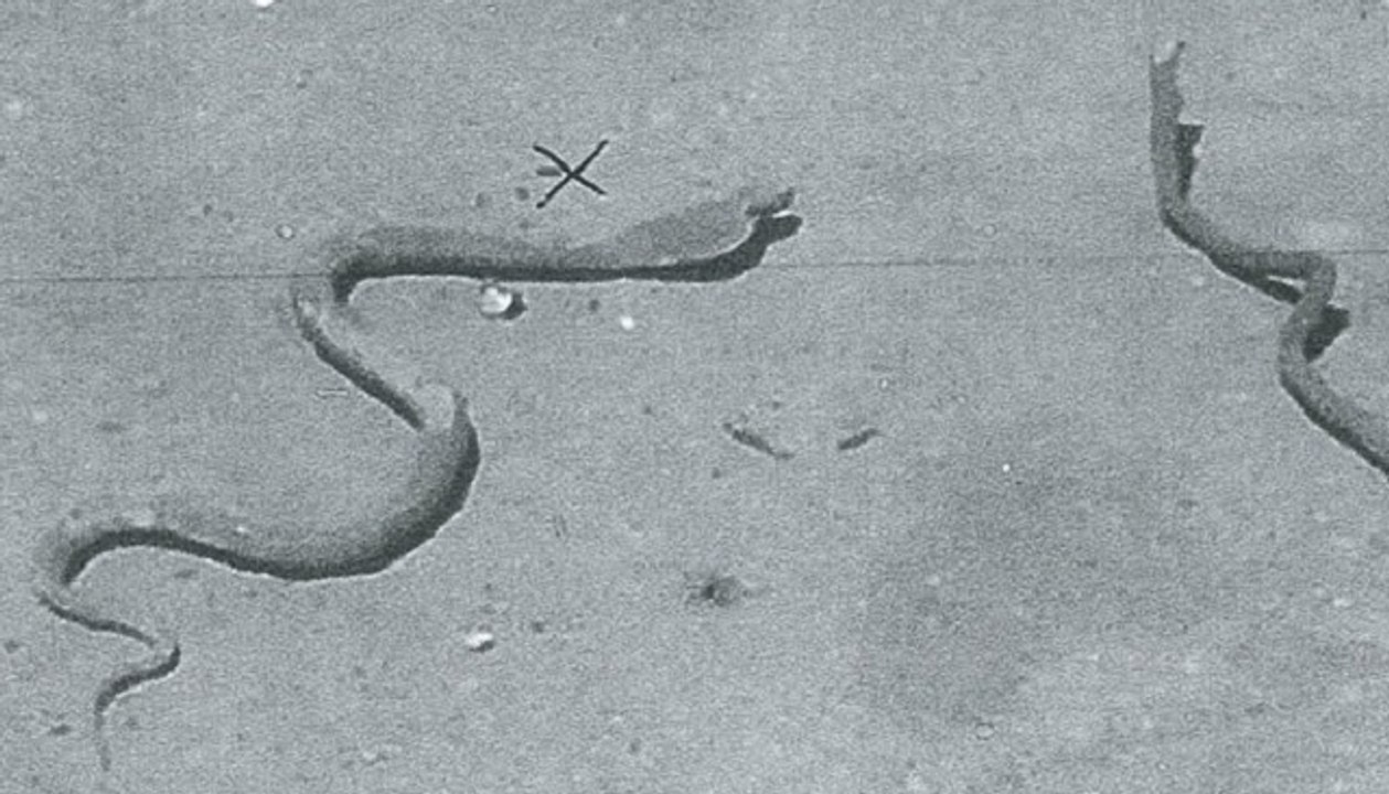 Le 18:18 : chasse au cobra géant dans un parc marseillais