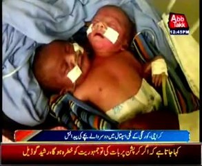 Two-headed baby born in Karachi