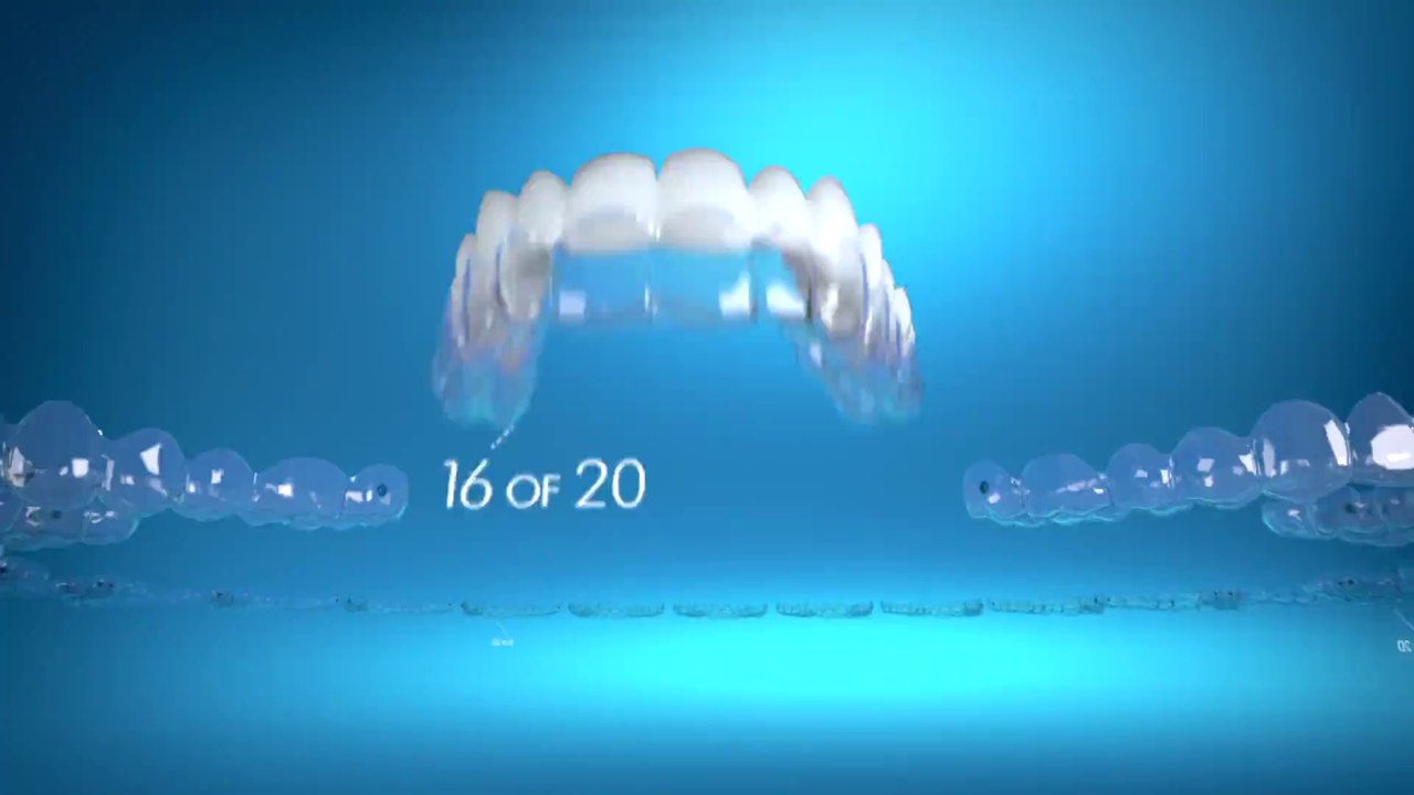 Invisalign Torrance ca