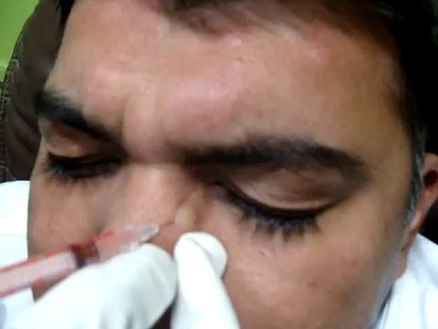 Botox Treatment in Pune - Dr Pradeep Kumari at Botox Injection Demonstration