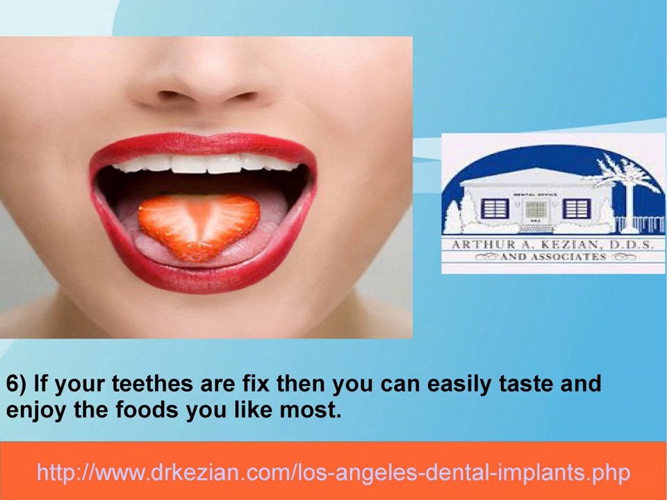 7 Benefits Of Dental Implants