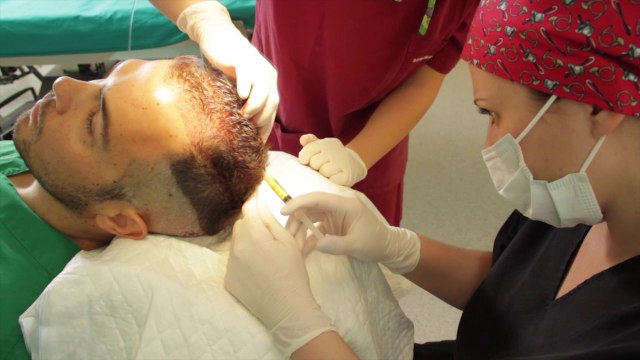 Hair Transplantation - G.A.T. - PRP Injections