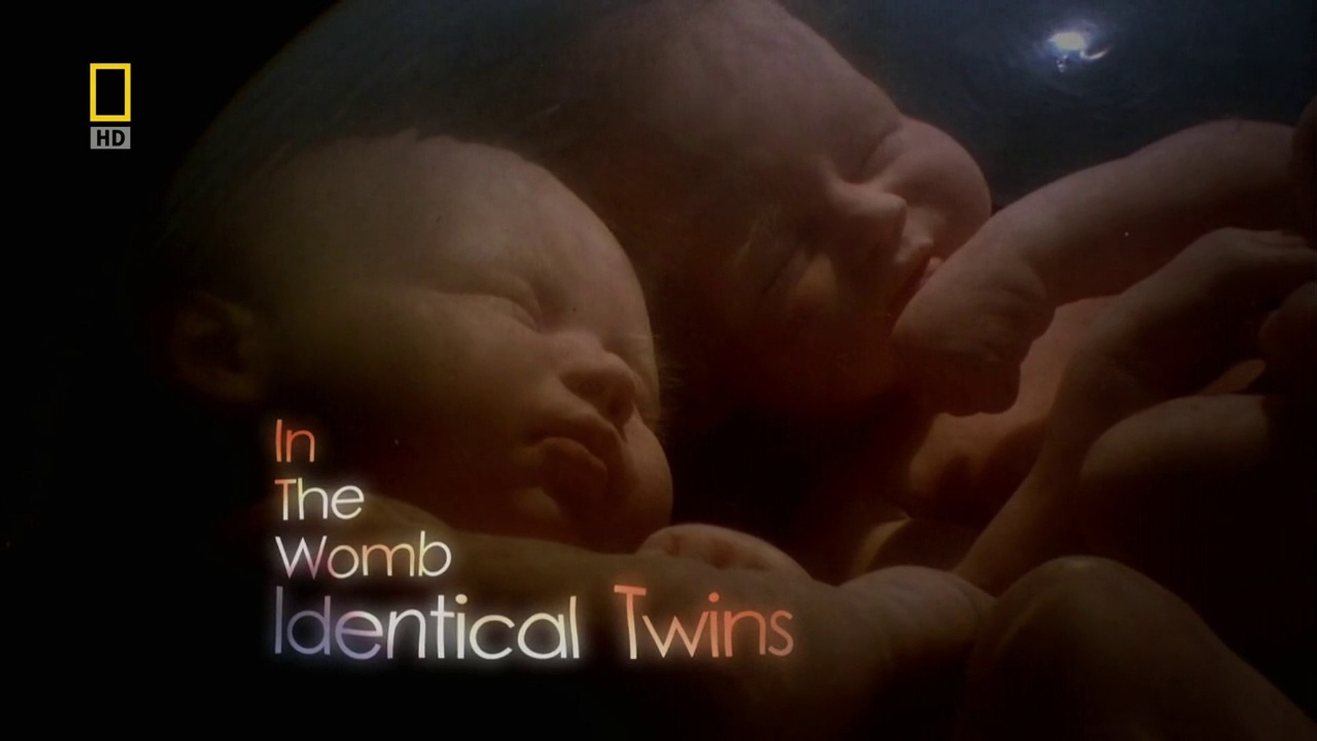 Притча про младенцев в утробе матери. Однояйцевые Близнецы в утробе. Близнец в близнеце в утробе.
