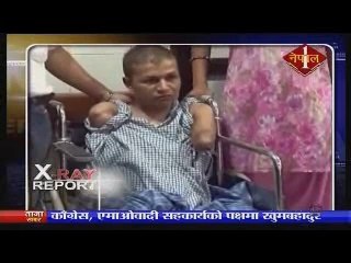 X RAY Report 20th sept 2014 pt 1