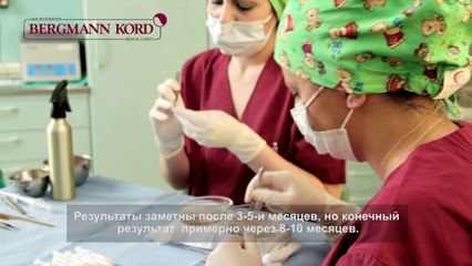 Бесшовная пересадка волос FUE