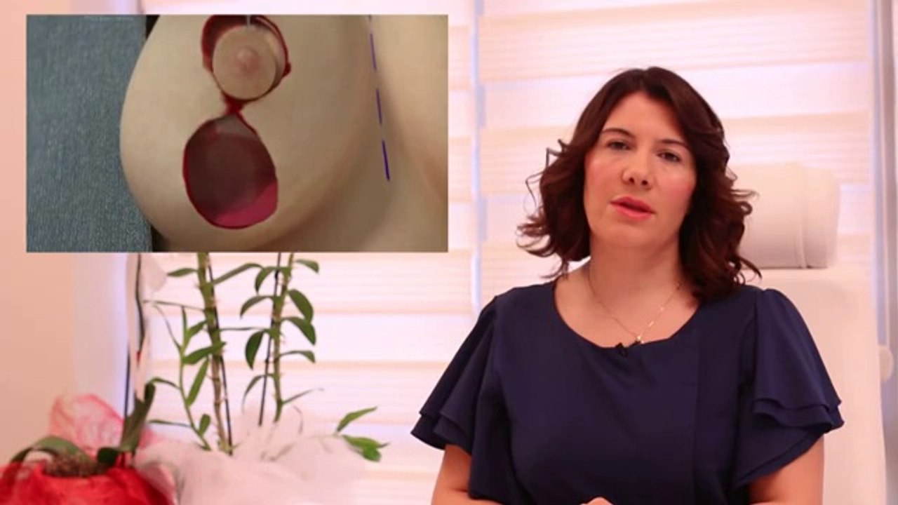 Op.Dr. Ayşegül Sivri Meme Dikleştirme