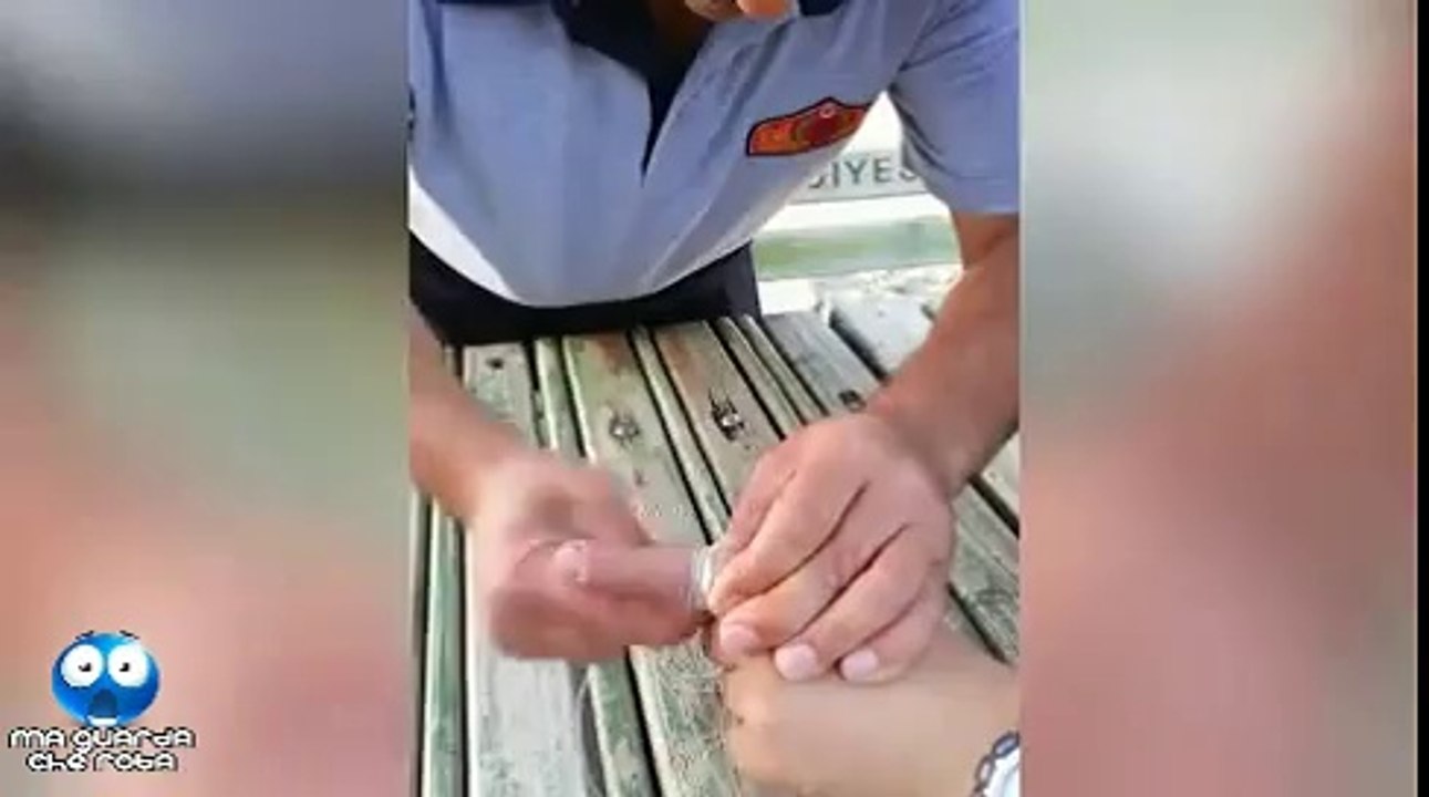 Trucchetto incredibile per rimuovere un anello dal dito