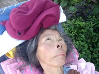 老人ホーム千葉市日本 peg tube feeding