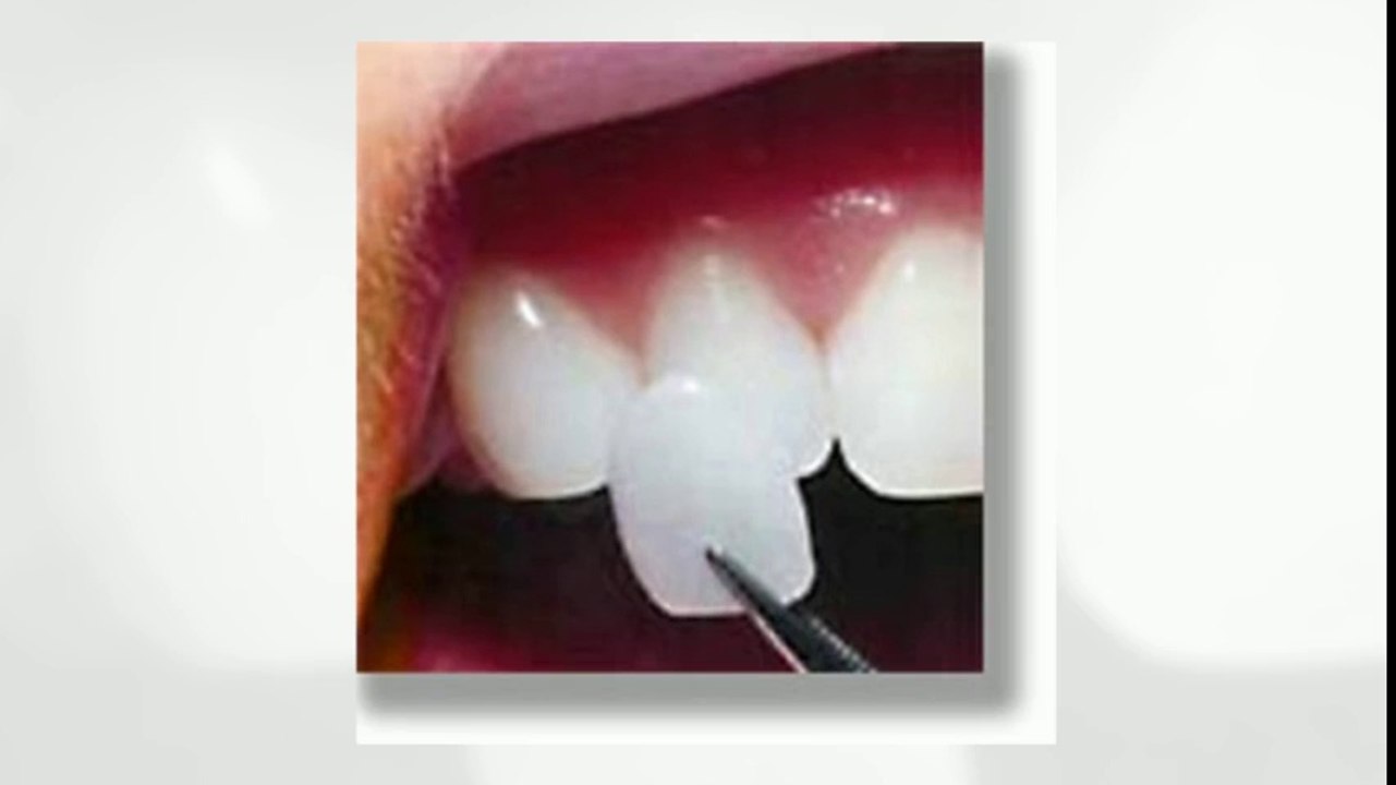 Lifetime Smiles Austin Cosmetic Dentists Sept2014