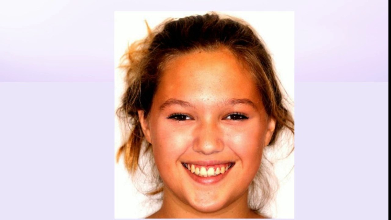 Weddle Orthodontist Thornton CO Sept2014