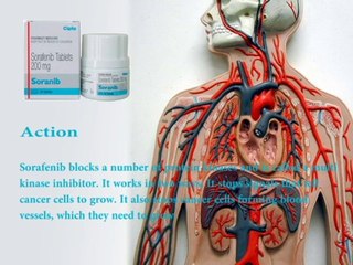 Buy Sorafenib 200 Mg Tablet online From "Cheapharmacy"