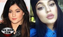 KYLIE JENNER Sports Larger Lips, Gets Emotional on Instagram after Kris & Bruce Jenner’s Divorce