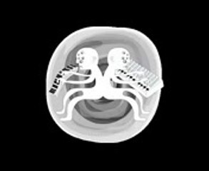 Aphex Twin  Untitled 01