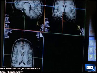 Dunya News - Is your brain male or female?
