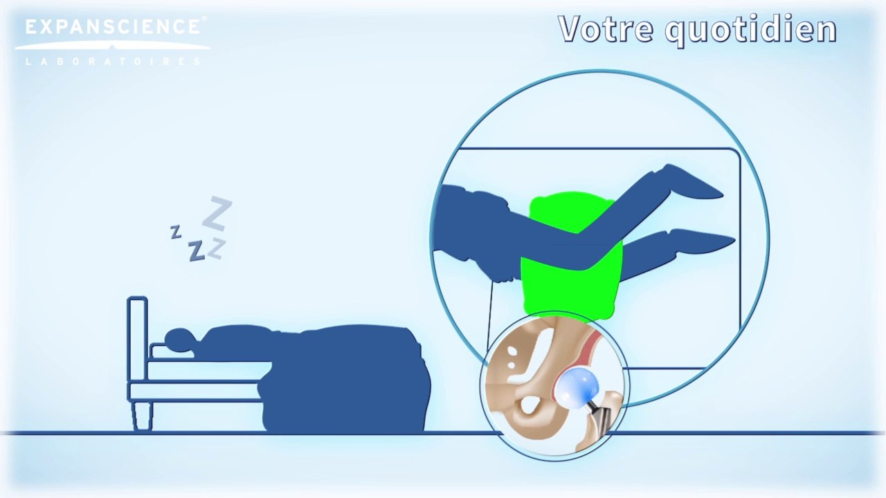 Bien vivre avec sa prothèse de hanche | Arthrolink