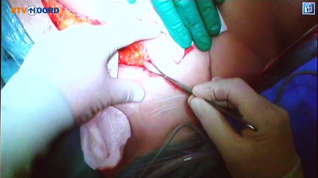 Veel belangstelling voor meekijken met borstreconstructie - RTV Noord