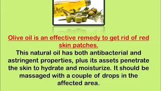 Home Remedies To Get Rid Of Rosacea - Clear Up Rosacea Fast