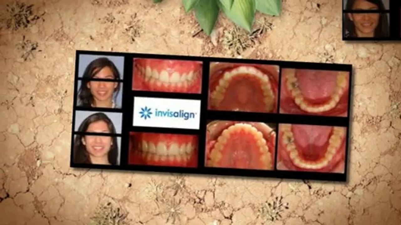 Braces Summerlin