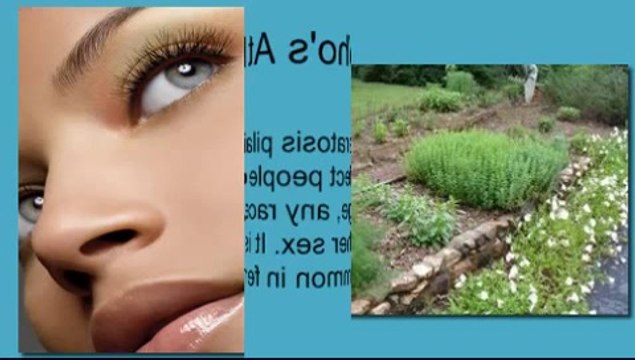 Living With KP Review: Jennifer Richards Keratosis Pilaris Ebook