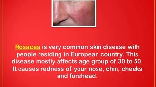How To Cure Rosacea Redness Naturally - natural treatment for rosacea