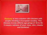 How To Cure Rosacea Redness Naturally - natural treatment for rosacea