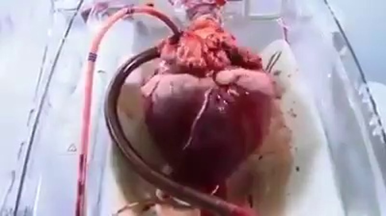 Wow! Amazing! .. must watch