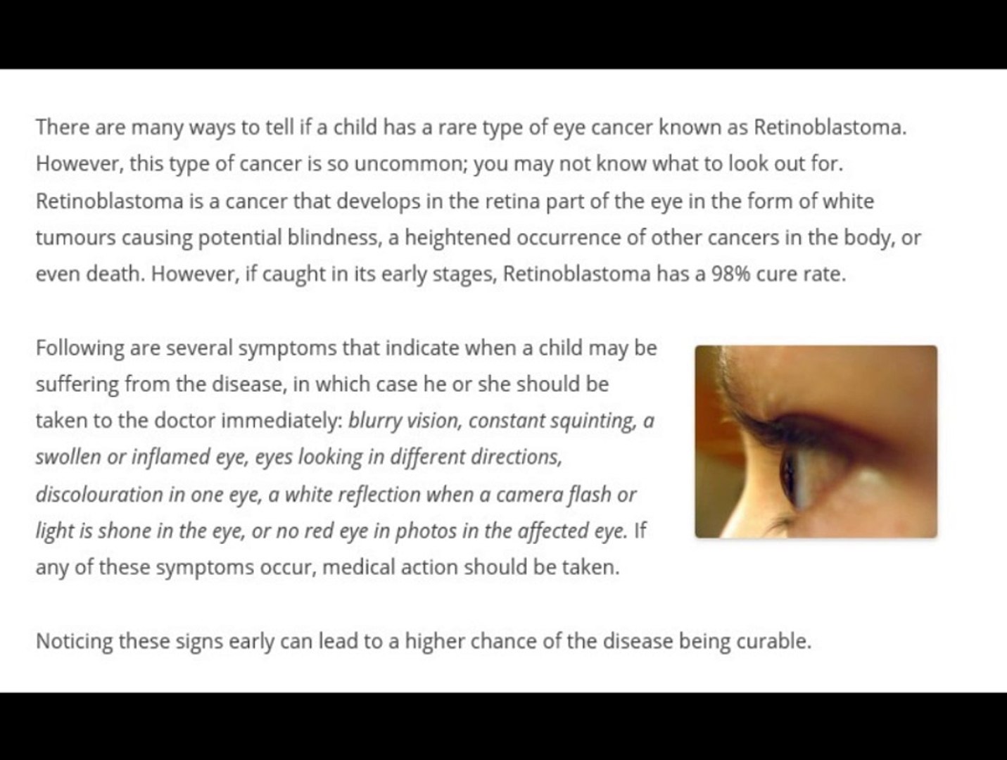 Brian Barso | Childhood Eye Cancer Awareness - Signs of Retinoblastoma