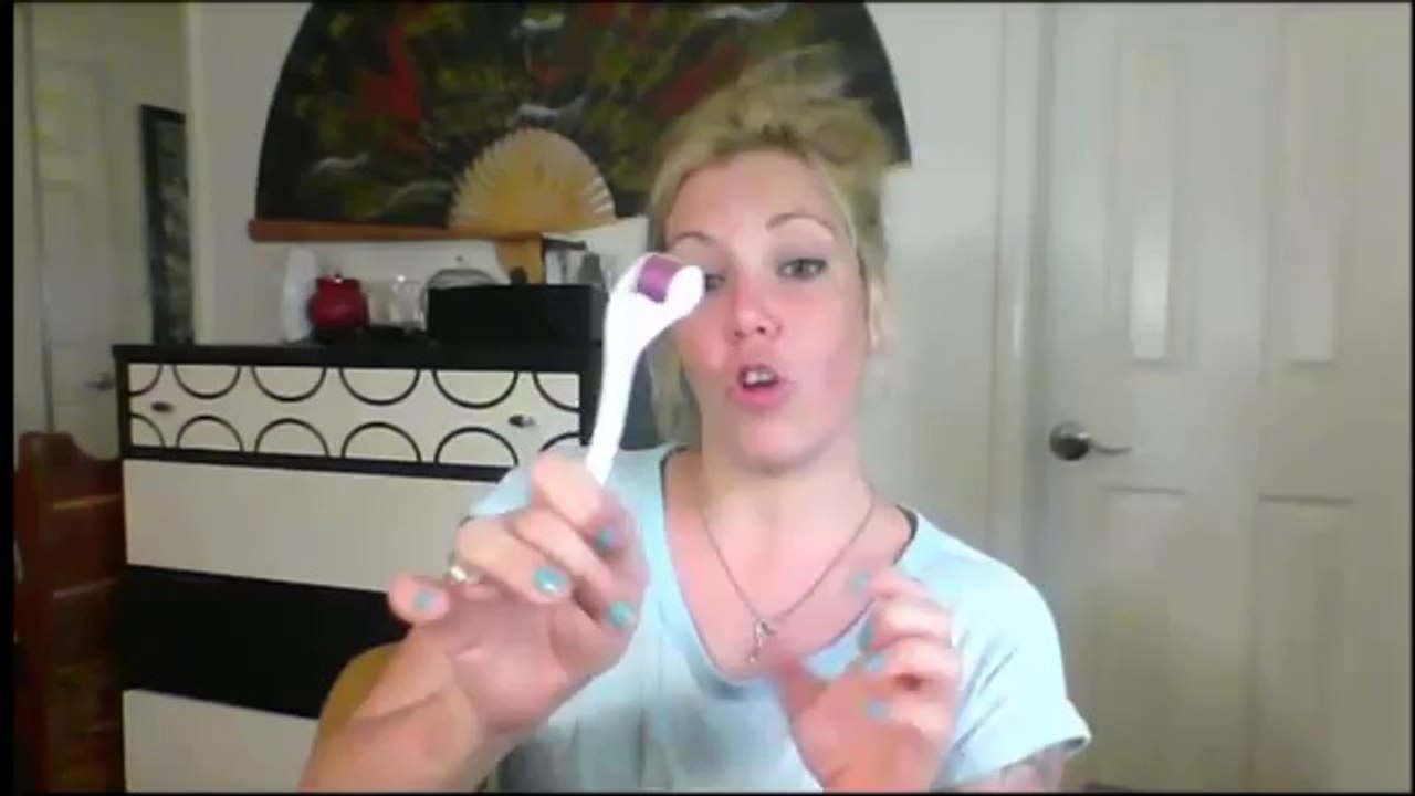 Laser treatment for acne scars is less effective than a dermaroller