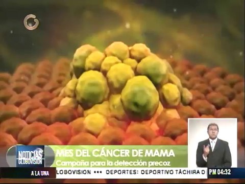 El cáncer de mama puede curarse mediante detección temprana