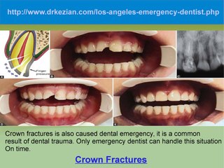 6 Common Dental Emergencies