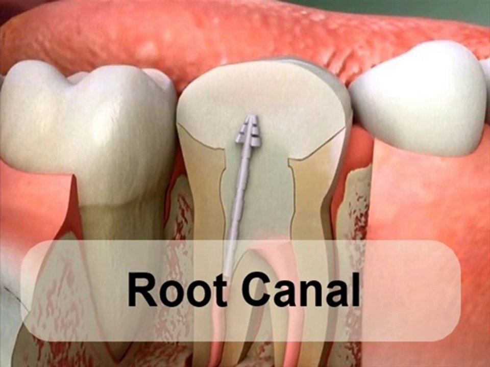 8 Treatments For Complete Smile Makeover
