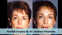 Kleinman Plastic Surgery Facelift Procedure