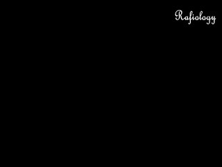 HUM KO DUAEN DO TUMHEN QATIL BANA DIYA - (Pehli Raat - 1959)