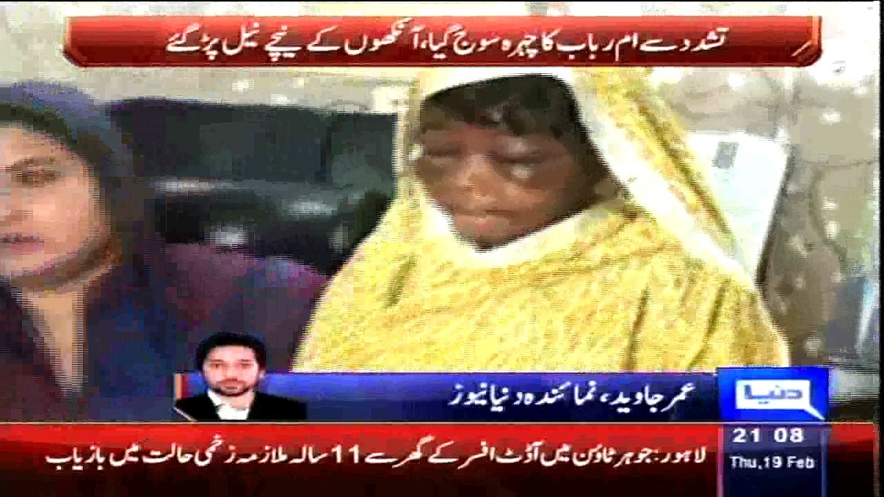 Lahore: child domestic labourer severely beaten, tortured by govt official's wife