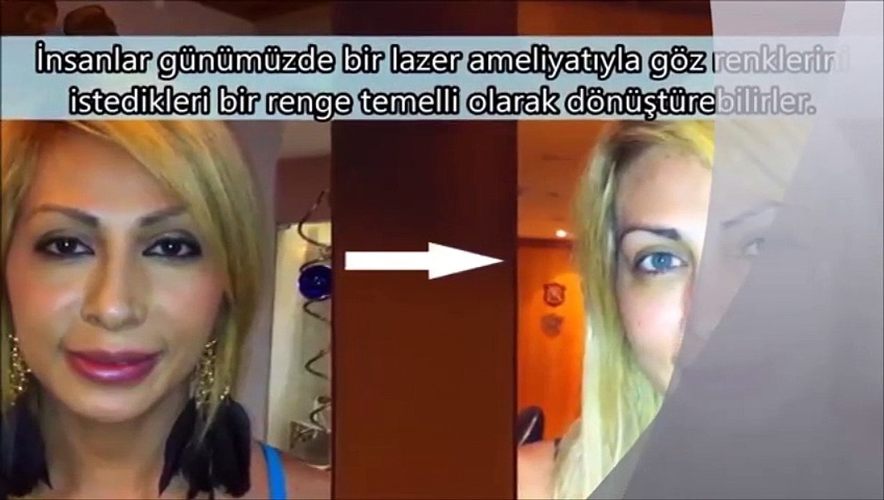 Gözleriniz Hakkında Bilmediğiniz 11 Şaşırtıcı Bilgi