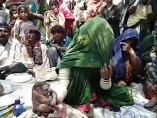 Astaghfirullah baby born without brain in pakistan