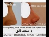 Most advanced plastic surgery in the world by distinguished surgeon Dr. Mohammed Faig Abad Alrazak,