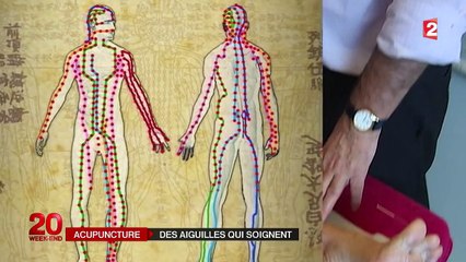 Médecine : la chasse des acupuncteurs non reconnus