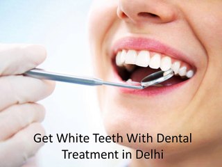 Get White Teeth With Dental Treatment in Delhi