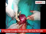 2 Yaşındaki Çocuğun Böbreğinden 300 Gram Kist Çıktı