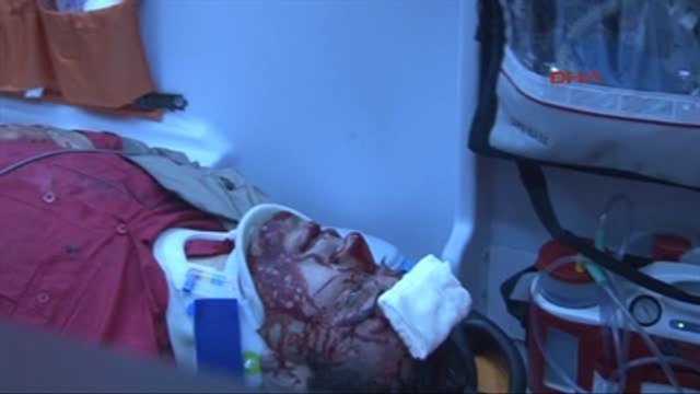 Otomobil Bariyerleri Aşıp Metrobüs Yoluna Girdi; 2 Yaralı