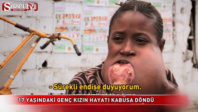 17 yaşındaki genç kızın hayatı kabusa döndü