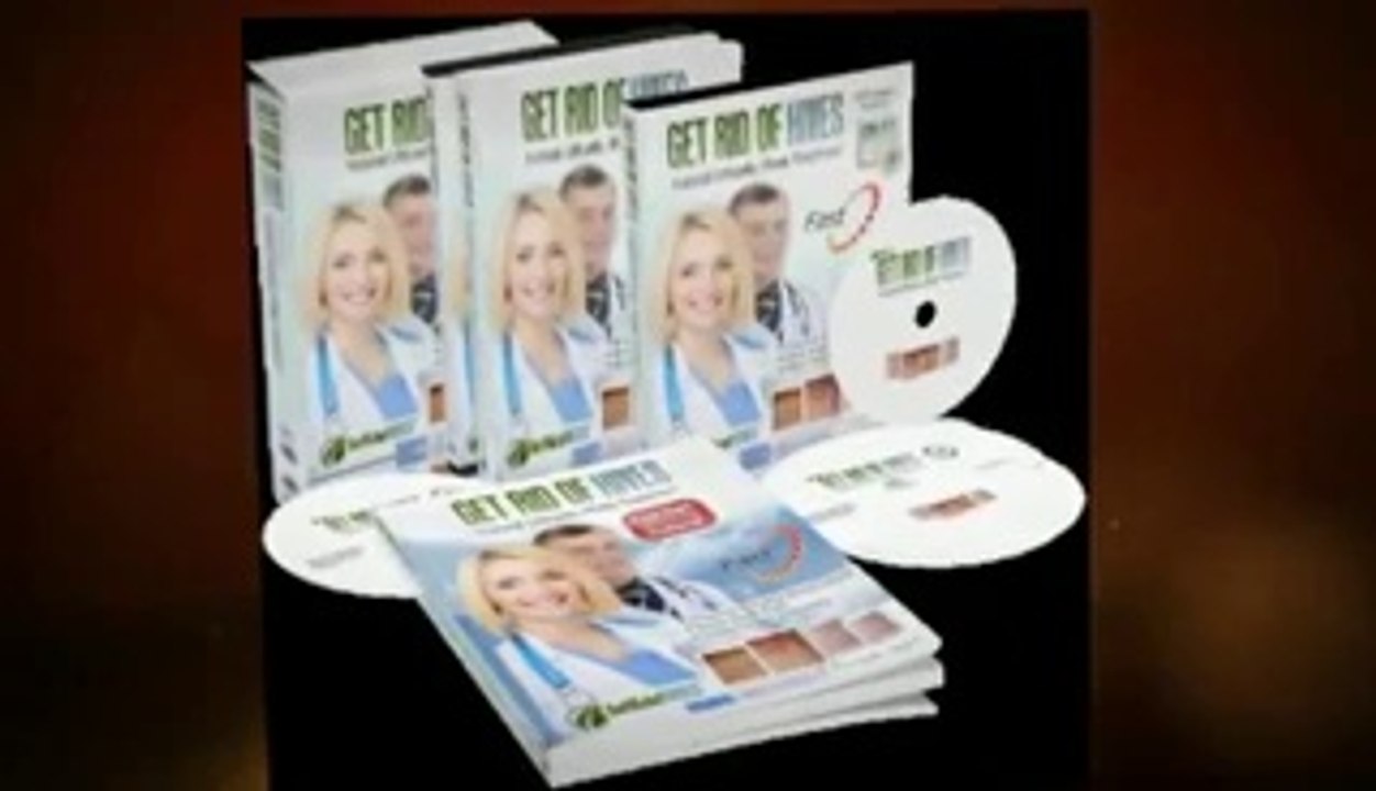 Get Rid Of Hives-Urticaria Hives Treatment