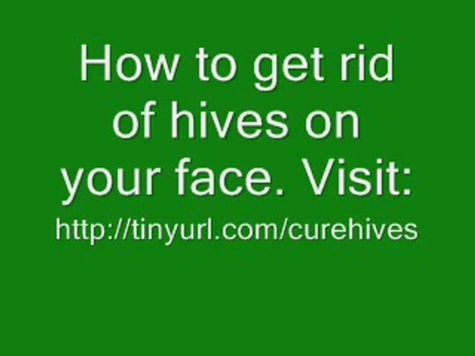 How to get rid of hives on your face